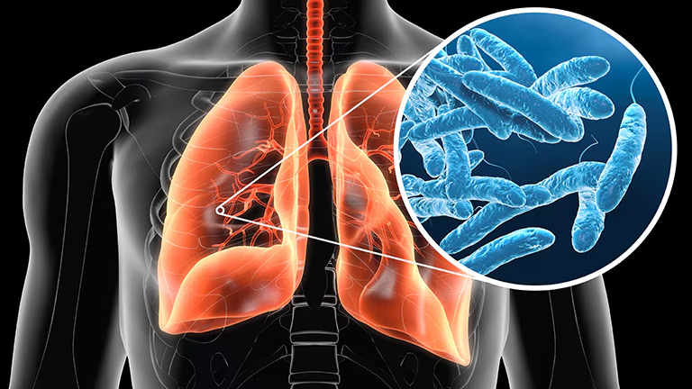 Growing Legionnaires’ Disease Outbreak in NYC’s Harlem Claims Two Lives, Sickens Over 58 Growing Legionnaires’ Disease Outbreak